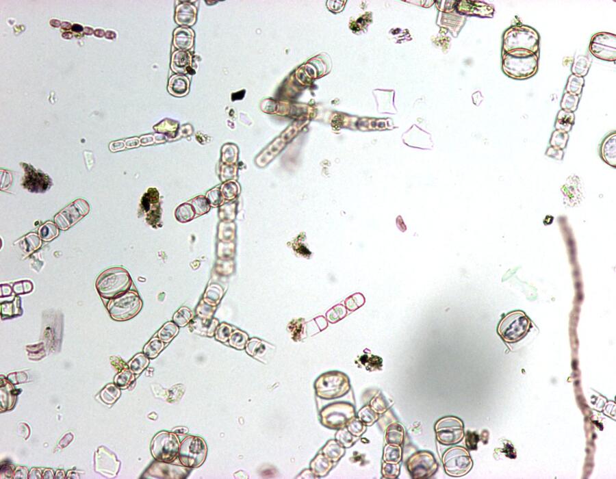 43_melosira_100x.jpg