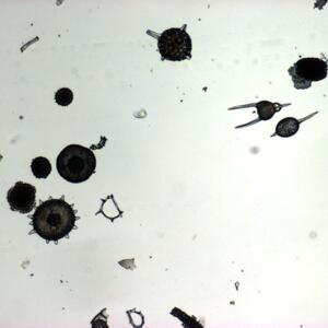 60_radiolaria_40x.jpg