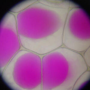 650px-rhoeo_discolor_plasmolysis.jpg