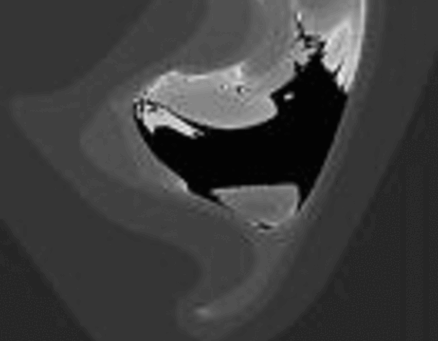 highf-zanim-slow.gif