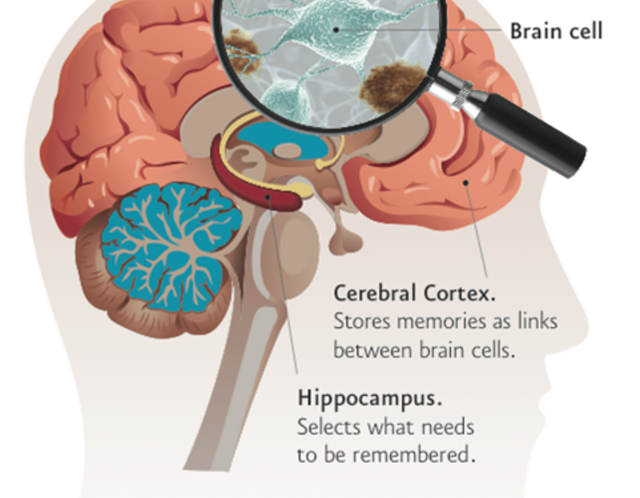plaque-diagram.-neal-barnard.-power-foods-for-the-brain.-1.14.13.png
